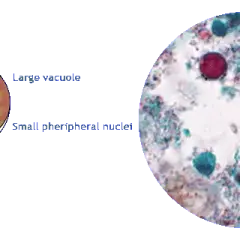 Blastocystis hominis: Jak rozpoznać i skutecznie leczyć?