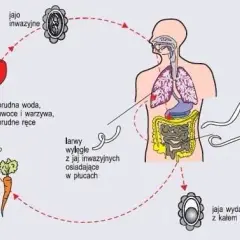 Pasożyty w ciele: 7 alarmujących objawów i co robić?