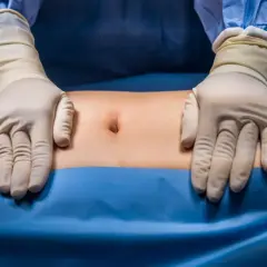 Ręce w rękawiczkach chirurgicznych badają brzuch pacjenta, przygotowując się do operacji przepukliny brzusznej.