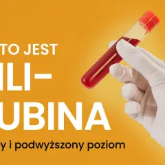 Ręka w rękawiczce trzyma probówkę z krwią. Tekst informuje: "Co to jest bilirubina - normy i podwyższony poziom".