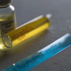 Test candida: Jak przebiega i co może wykryć? Wyjaśniamy