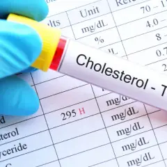Jak stres podnosi cholesterol i co możesz z tym zrobić dla zdrowia