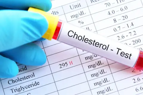 Jak stres podnosi cholesterol i co możesz z tym zrobić dla zdrowia
