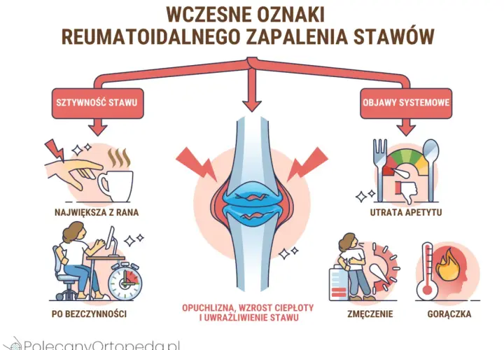 Wczesne objawy rzs: sztywność stawu, opuchlizna, zmęczenie, utrata apetytu i gorączka.