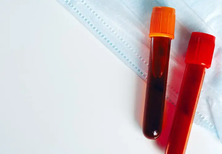 Dwie probówki z krwią, jedna z pomarańczową, druga z czerwoną zakrętką, leżą na masce ochronnej. Wyniki badania kreatyniny wkrótce będą gotowe.