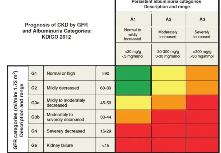 Tabela prognozy PChN wg kategorii GFR i albuminurii KDIGO 2012. Kolory wskazują ryzyko: zielony (niskie), żółty (umiarkowane), pomarańczowy (wysokie), czerwony (bardzo wysokie).