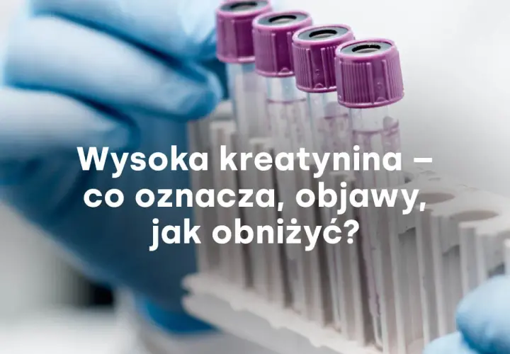 Rękawiczka laboratoryjna trzyma probówki. Tekst: Wysoka kreatynina – co oznacza, objawy, jak obniżyć?