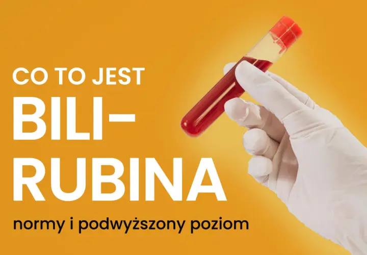 Ręka w rękawiczce trzyma probówkę z krwią. Tekst informuje: "Co to jest bilirubina - normy i podwyższony poziom".