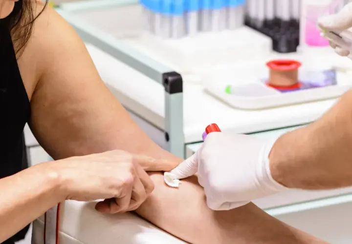 Pobieranie krwi do badań. Ręka pacjentki z widocznymi żyłami, pielęgniarka w białej rękawiczce przygotowuje miejsce wkłucia. W tle probówki i sprzęt medyczny. MPV niskie.