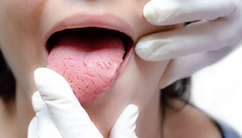 Candida u dzieci: Jakie są objawy i metody skutecznego leczenia?