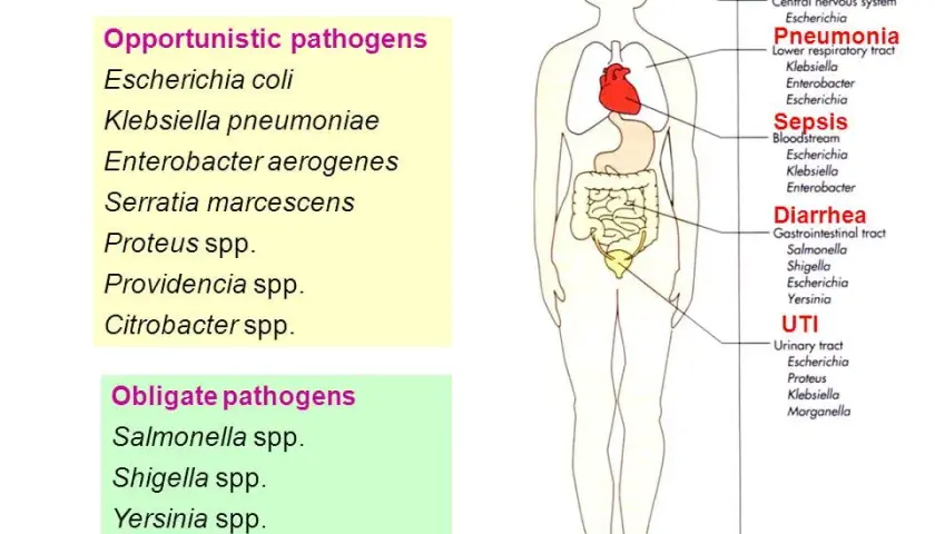 Bacterium lactis aerogenes: 5 kluczowych faktów dla zdrowia