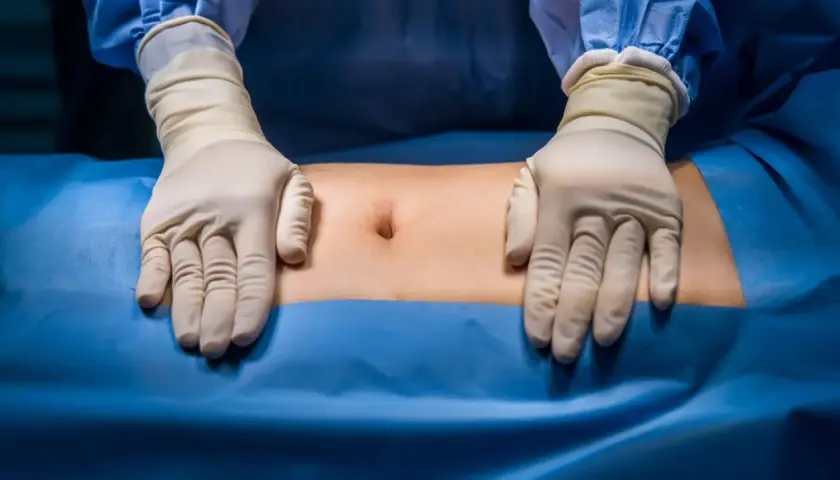 Ręce w rękawiczkach chirurgicznych badają brzuch pacjenta, przygotowując się do operacji przepukliny brzusznej.