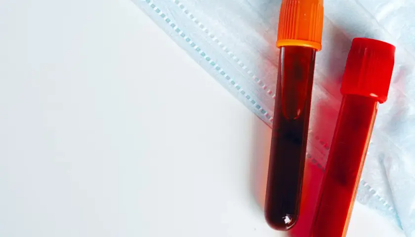 Dwie probówki z krwią, jedna z pomarańczową, druga z czerwoną zakrętką, leżą na masce ochronnej. Wyniki badania kreatyniny wkrótce będą gotowe.