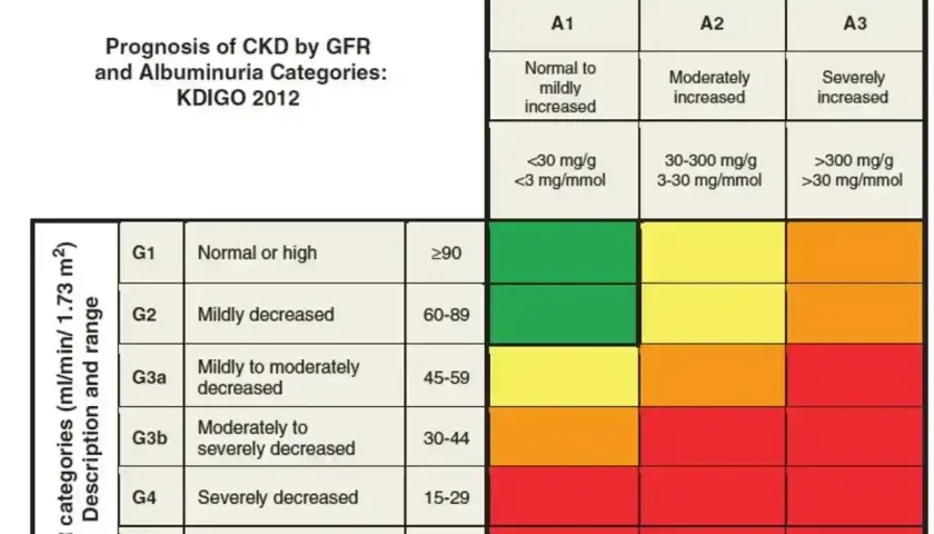 Tabela prognozy PChN wg kategorii GFR i albuminurii KDIGO 2012. Kolory wskazują ryzyko: zielony (niskie), żółty (umiarkowane), pomarańczowy (wysokie), czerwony (bardzo wysokie).