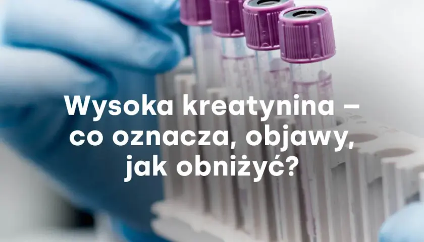 Rękawiczka laboratoryjna trzyma probówki. Tekst: Wysoka kreatynina – co oznacza, objawy, jak obniżyć?