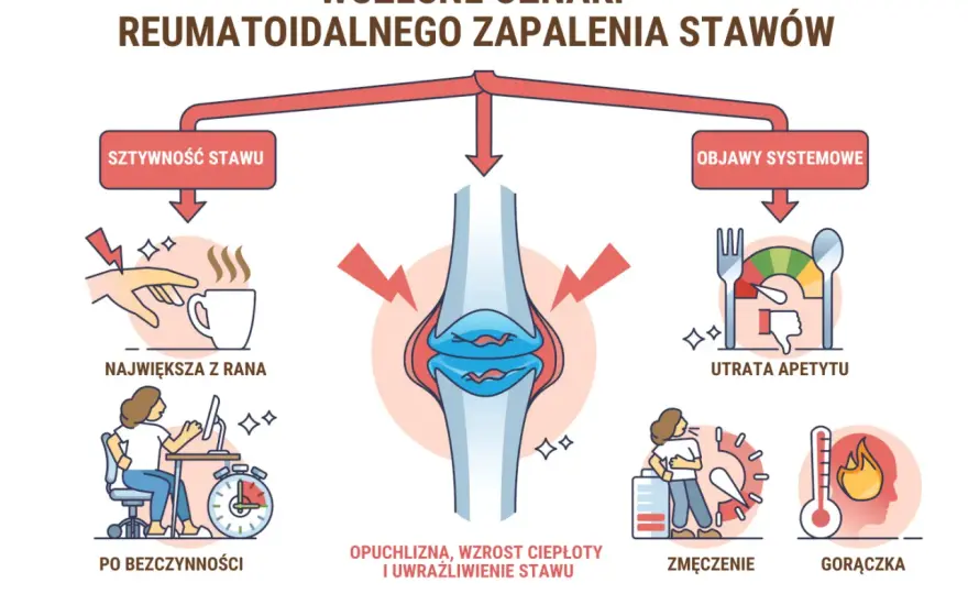 RZS - objawy, leczenie i diagnostyka. Czy to zwykły ból stawów?