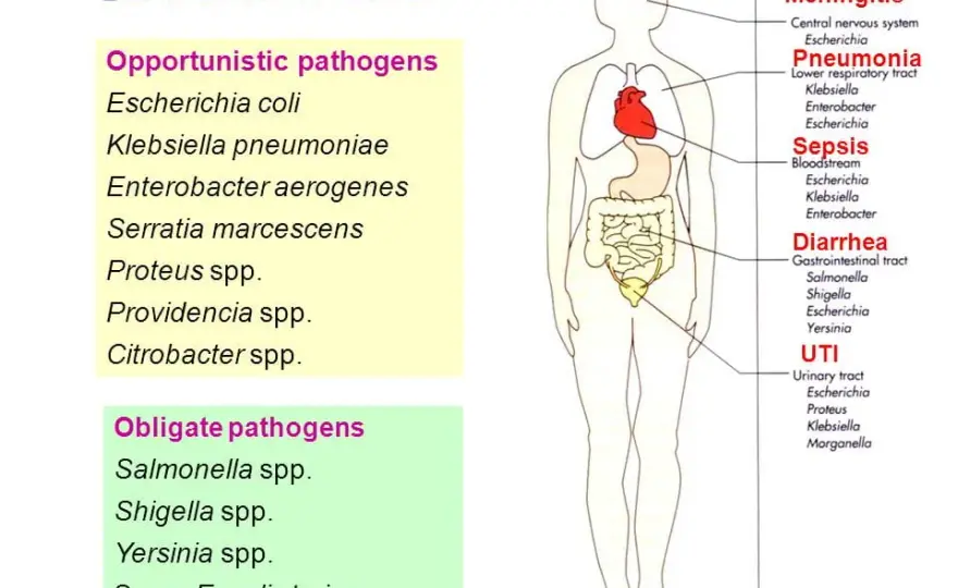 Bacterium lactis aerogenes: 5 kluczowych faktów dla zdrowia