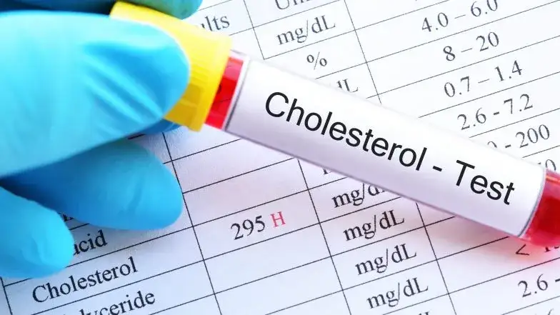 Zdjęcie Wysoki cholesterol a zdrowie: Jakie groźby mogą cię zaskoczyć?