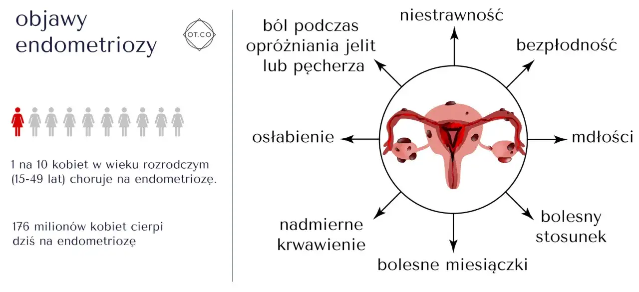 Objawy endometriozy: ból, niestrawność, bezpłodność, mdłości, bolesny stosunek, bolesne miesiączki, nadmierne krwawienie, osłabienie. 1 na 10 kobiet choruje.